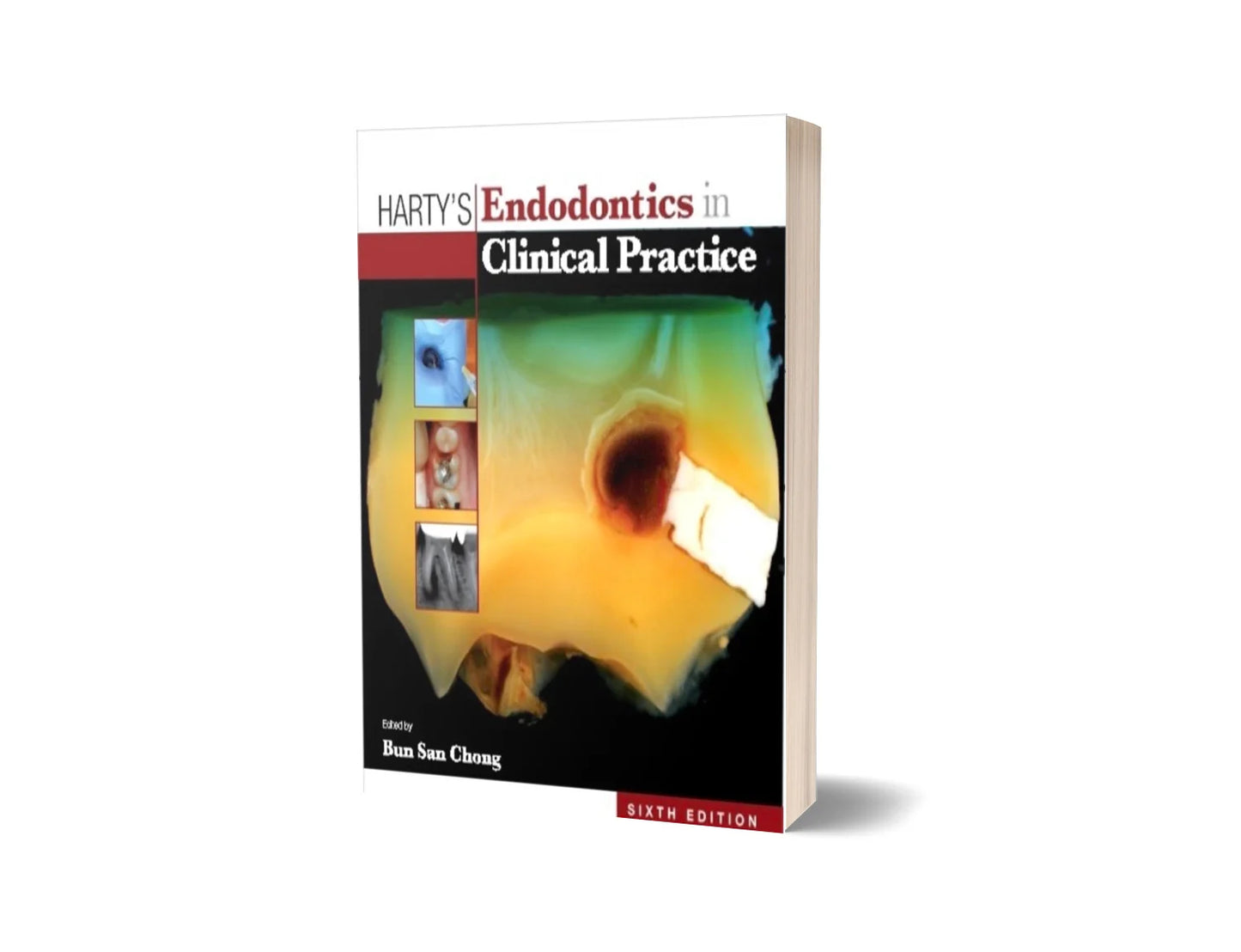Harty's Endodontics in Clinical Practice - Colored (6th Edition)