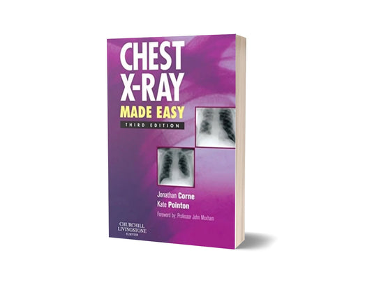 Chest X-Ray Made Easy (3rd Edition)